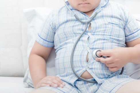 Sağlıksız beslenme, hareketsizlik ve değişen toplumsal alışkanlıklar nedeniyle çocuklarda obezite dünyada ve ülkemizde hızla artıyor.