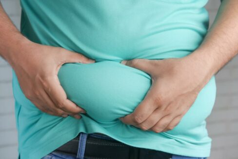 Obezite, vücuttaki yağ dokusunun normalden fazla olması halidir.