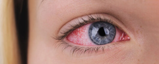 Uzmanlar Göz Enfeksiyonlarının Düşündüğünüzden Çok Daha Ciddi