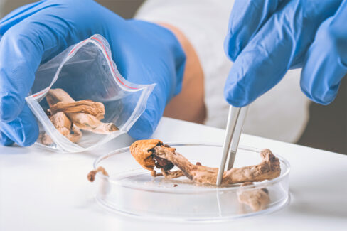 Alzheimer ve psilosibin